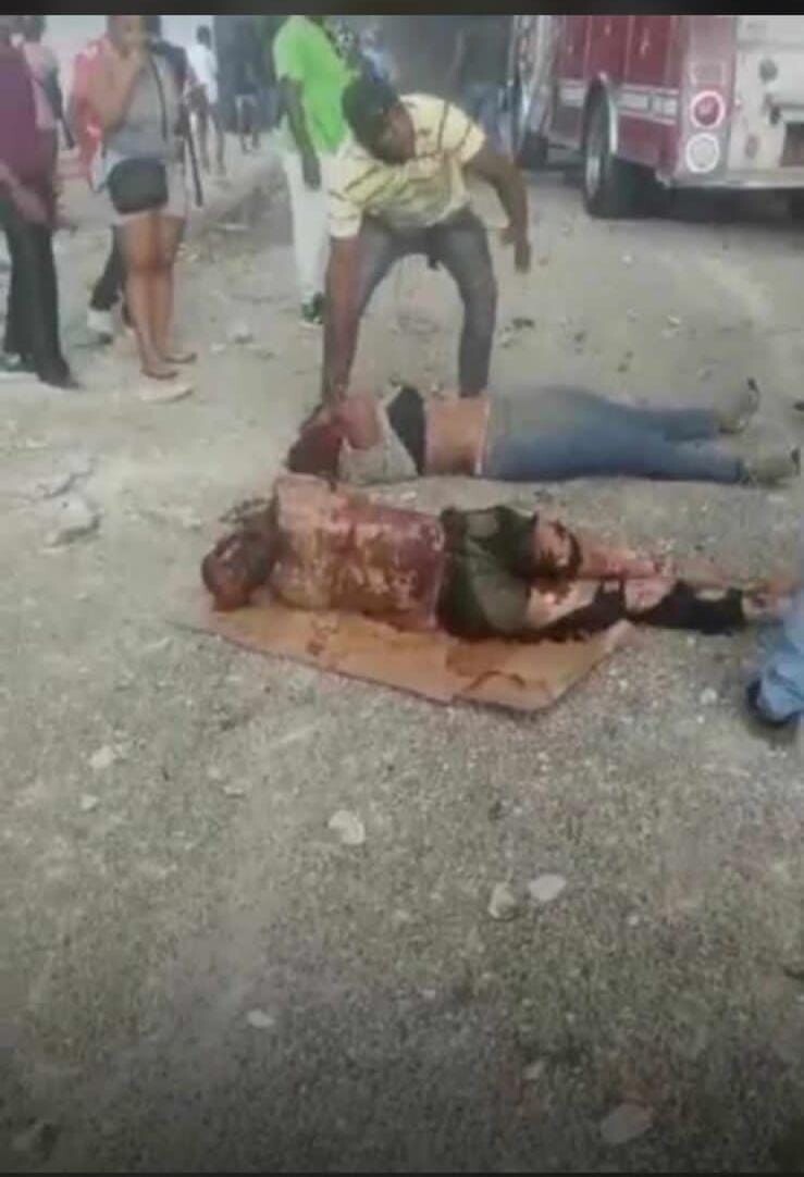 Personas heridas con quemaduras graves Personas heridas con quemaduras graves