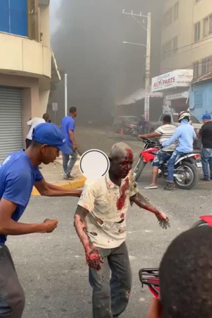 Varios heridos Varios heridos