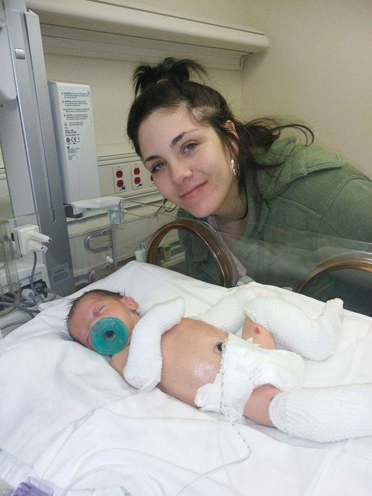 Help Save Easton- baby battling Epidermolysis Bullosa- EB
