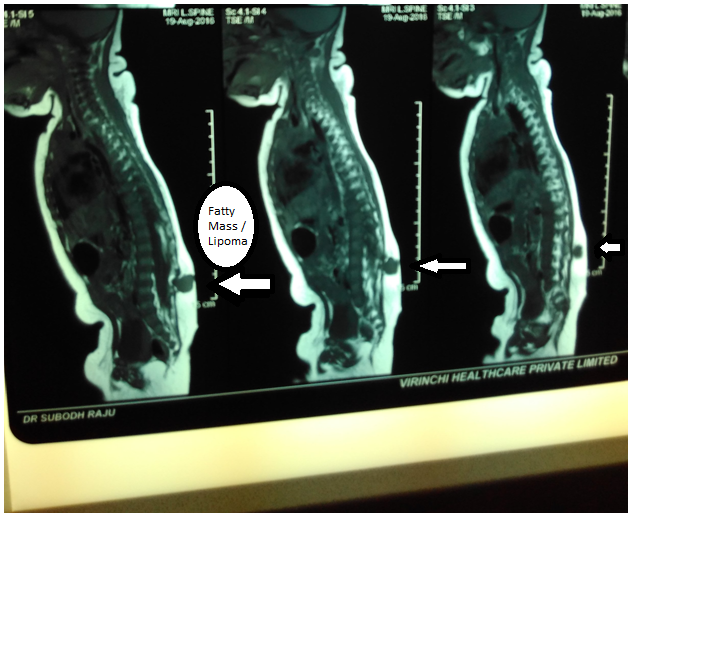 MRI Scan image