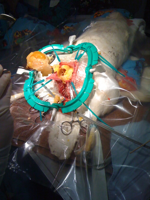 This is Jacinda during her surgery!