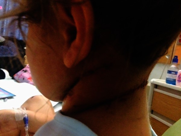 After surgery on deep lacerations on Payton's neck