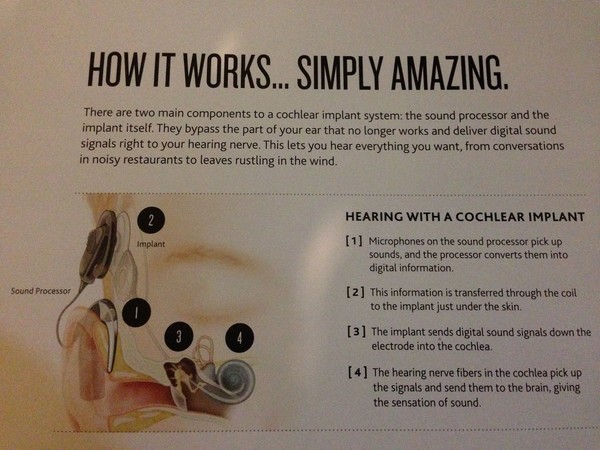 How the cochlear works