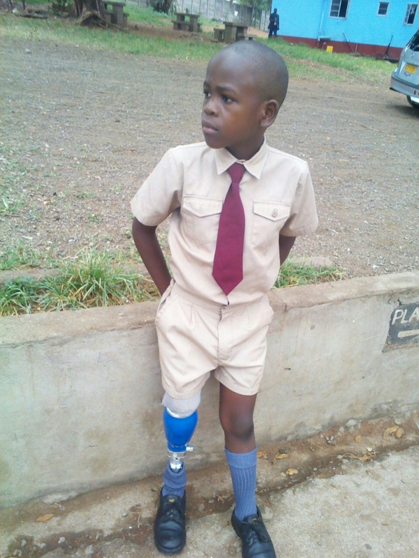 Pride with his current too-small limb